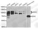 Enhancer Of Zeste 2 Polycomb Repressive Complex 2 Subunit antibody, A5743, ABclonal Technology, Western Blot image 