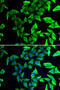 Visinin Like 1 antibody, 18-817, ProSci, Immunofluorescence image 