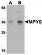 Transmembrane Protein 173 antibody, TA306811, Origene, Western Blot image 
