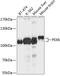 Peroxisomal Biogenesis Factor 6 antibody, A04353, Boster Biological Technology, Western Blot image 