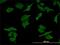Dihydropyrimidine Dehydrogenase antibody, H00001806-M01, Novus Biologicals, Immunocytochemistry image 