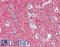 Solute Carrier Family 25 Member 28 antibody, LS-B3556, Lifespan Biosciences, Immunohistochemistry paraffin image 