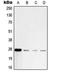 Ubiquitin C-Terminal Hydrolase L1 antibody, orb214714, Biorbyt, Western Blot image 