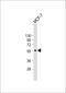 25-hydroxyvitamin D-1 alpha hydroxylase, mitochondrial antibody, M01370, Boster Biological Technology, Western Blot image 
