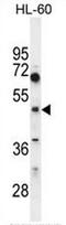 Choline/Ethanolamine Phosphotransferase 1 antibody, AP50865PU-N, Origene, Western Blot image 
