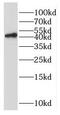 DNA repair protein RAD51 homolog 2 antibody, FNab07082, FineTest, Western Blot image 