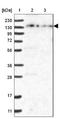 Zinc Finger FYVE-Type Containing 16 antibody, NBP1-81516, Novus Biologicals, Western Blot image 