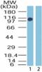 Zinc finger protein 198 antibody, 48-915, ProSci, Western Blot image 