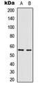 Vimentin antibody, LS-C358406, Lifespan Biosciences, Western Blot image 