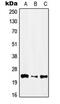 Interferon alpha-1 antibody, MBS820329, MyBioSource, Western Blot image 