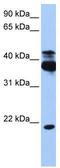 Serine/Threonine Kinase 38 antibody, TA346762, Origene, Western Blot image 