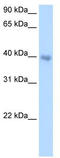 Distal-Less Homeobox 5 antibody, TA332068, Origene, Western Blot image 