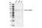 Forkhead Box O1 antibody, 76764S, Cell Signaling Technology, Western Blot image 