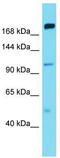 Mitogen-Activated Protein Kinase Kinase Kinase Kinase 5 antibody, TA331516, Origene, Western Blot image 