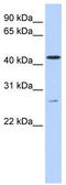 Acyl-CoA Binding Domain Containing 5 antibody, TA335956, Origene, Western Blot image 