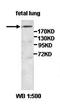 AF4/FMR2 Family Member 2 antibody, orb77515, Biorbyt, Western Blot image 