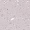 CD40 Molecule antibody, HPA031568, Atlas Antibodies, Immunohistochemistry paraffin image 