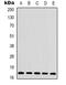 Histone H3 antibody, orb338862, Biorbyt, Western Blot image 