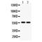 Aldehyde dehydrogenase, mitochondrial antibody, LS-C407685, Lifespan Biosciences, Western Blot image 