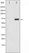 Cell Division Cycle 25A antibody, TA325325, Origene, Western Blot image 
