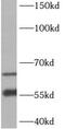 Beta-1,3-N-Acetylgalactosaminyltransferase 2 antibody, FNab00763, FineTest, Western Blot image 