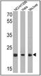 Proteasome Subunit Beta 5 antibody, GTX23330, GeneTex, Western Blot image 