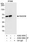 RAD23 Homolog B, Nucleotide Excision Repair Protein antibody, A302-305A, Bethyl Labs, Immunoprecipitation image 