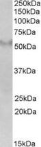 Fibronectin type III and SPRY domain-containing protein 1 antibody, TA311519, Origene, Western Blot image 