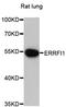 Mig6 antibody, LS-C748162, Lifespan Biosciences, Western Blot image 