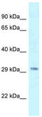 Lysine Methyltransferase 5B antibody, TA339160, Origene, Western Blot image 
