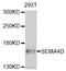 Semaphorin 4D antibody, STJ112175, St John