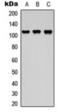 ArfGAP With SH3 Domain, Ankyrin Repeat And PH Domain 2 antibody, orb360740, Biorbyt, Western Blot image 