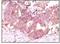 Fibroblast Growth Factor 2 antibody, LS-C171360, Lifespan Biosciences, Immunohistochemistry paraffin image 