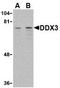 ATP-dependent RNA helicase DDX3X antibody, TA306300, Origene, Western Blot image 