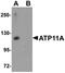 ATPase Phospholipid Transporting 11A antibody, orb75463, Biorbyt, Western Blot image 