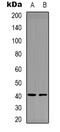 Coagulation Factor XII antibody, orb338820, Biorbyt, Western Blot image 