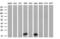 Nucleoside diphosphate kinase, mitochondrial antibody, GTX84032, GeneTex, Western Blot image 