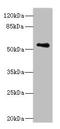 Zinc Finger And SCAN Domain Containing 32 antibody, orb357819, Biorbyt, Western Blot image 