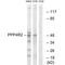 Protein Phosphatase 4 Regulatory Subunit 2 antibody, A10882, Boster Biological Technology, Western Blot image 