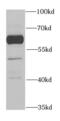 Biotinidase antibody, FNab00975, FineTest, Western Blot image 