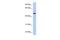 Ciliogenesis Associated TTC17 Interacting Protein antibody, PA5-44446, Invitrogen Antibodies, Western Blot image 