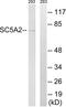 Sodium/glucose cotransporter 2 antibody, LS-C120403, Lifespan Biosciences, Western Blot image 