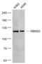 RNA Binding Motif Protein 20 antibody, GTX52196, GeneTex, Western Blot image 