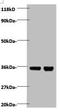Zinc finger BED domain-containing protein 1 antibody, A53917-100, Epigentek, Western Blot image 