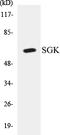 Serum/Glucocorticoid Regulated Kinase 1 antibody, EKC1518, Boster Biological Technology, Western Blot image 