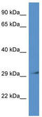 67 kDa laminin receptor antibody, TA335055, Origene, Western Blot image 