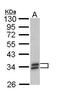 Sulfotransferase Family 1A Member 1 antibody, PA5-29766, Invitrogen Antibodies, Western Blot image 
