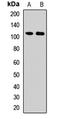 Dentin Sialophosphoprotein antibody, LS-C668856, Lifespan Biosciences, Western Blot image 