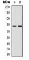 Rabphilin 3A antibody, LS-C368643, Lifespan Biosciences, Western Blot image 
