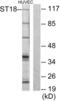 ST18 C2H2C-Type Zinc Finger Transcription Factor antibody, abx013301, Abbexa, Western Blot image 